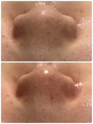 フェイシャルサロン CHIARA　美月のエステ・リラクイメージ