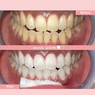 セルフホワイトニング エクシア中島公園店のその他イメージ