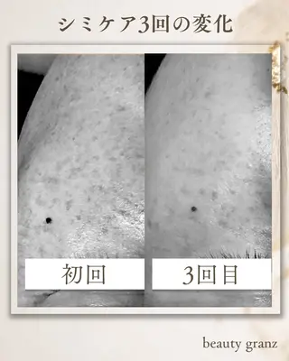 毛穴ニキビ専門 ビューティーグランツのエステ・リラクイメージ