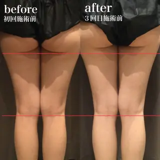 美肌脱毛i所属・美肌脱毛ｉ ｜泉大津のエステ・リラクイメージ