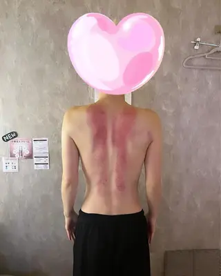 コルギ＆リラクゼーション　Acorde所属・小顔・巻肩・猫背ケア コルギ　Acordeのエステ・リラクイメージ