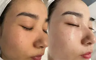 ネイル aliaハイフ&水光ジェットサロン所属・aliaハーブ水光店 エステティシャン募集のエステ・リラクイメージ