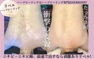 ハーブピーリング専門店HERBERRY難波心斎橋店所属・ハーブピーリング専門 HERBERRY冨永のエステ・リラクイメージ