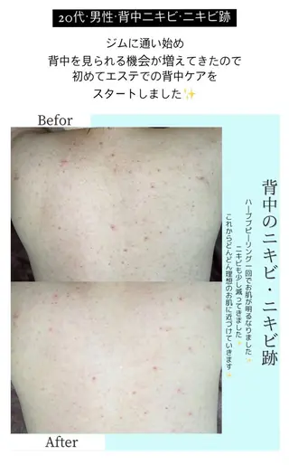 ベラージュ【美背中・ 美尻・フェイシャル】のエステ・リラクイメージ