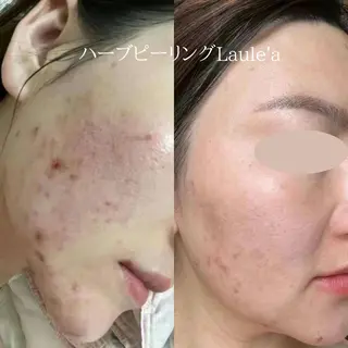 美腸サロン🌺 腸もみ/小顔/リンパのエステ・リラクイメージ