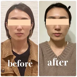 クリーム所属・Nakamura Mikiのエステ・リラクイメージ