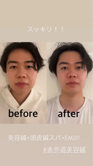 美容鍼灸サロン mahoroba院長のエステ・リラクイメージ