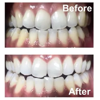 KalanDiva〜 ｶﾗﾝﾃﾞｨｰﾊﾞ〜のエステ・リラクイメージ