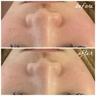 メンズ メナード岐阜茜部 杉浦のエステ・リラクイメージ