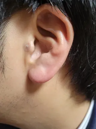 【快眠・視界クリア】 耳から整う心身メンテのエステ・リラクイメージ