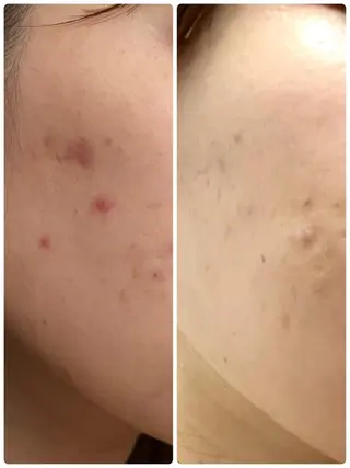 Mignon所属・mignon /栄のエステ・リラクイメージ