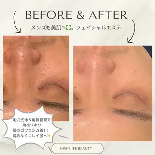 メンズ OPS×LIFE BEAUTY/maiのエステ・リラクイメージ