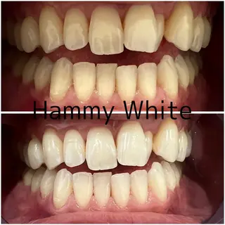 HammyWhite 心斎橋🌈AMIのその他イメージ