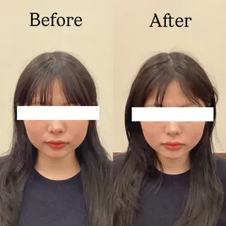 Hari Lounge恵比寿所属・chika🦋 ハリラウンジ恵比寿のエステ・リラクイメージ