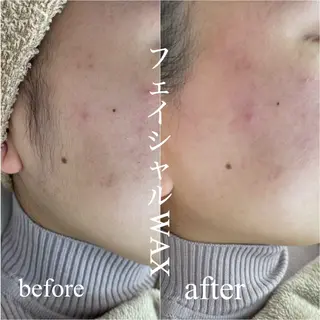 Callana所属・Callana KAYOのエステ・リラクイメージ