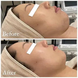 ララ/ハーブ メゾンリュバンのエステ・リラクイメージ