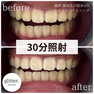 glitter.SHONAN所属・佐久間 茉弥のエステ・リラクイメージ