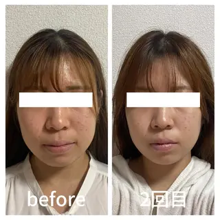 小顔サロン AMYONのエステ・リラクイメージ