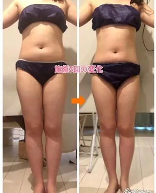 ショート カラー パーマ ヘアアレンジ メンズ キッズ ネイル マツエク・マツパ ‍痩身＆ボディ 結果出し🌟丹野のエステ・リラクイメージ