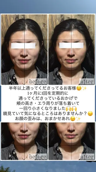 💎後悔させない小顔 矯正💎イトヤマ🌱のエステ・リラクイメージ