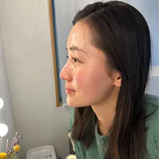 うなじ脱毛/美肌脱毛 LABELのエステ・リラクイメージ