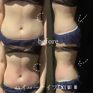 🧚‍♀️優来 リラク痩身肌質改善のエステ・リラクイメージ