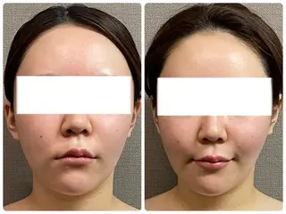 MIRAI小顔 溝の口店のエステ・リラクイメージ