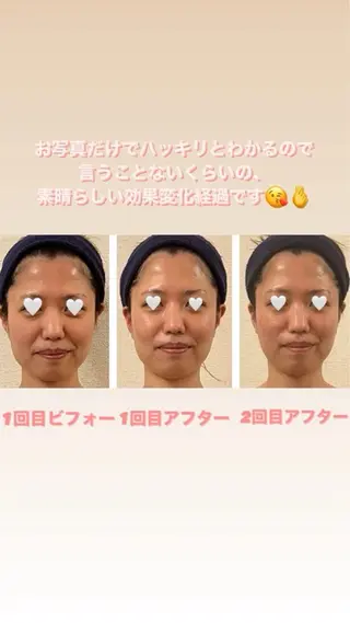 コルギサロンHonon所属・コルギサロン Hononのエステ・リラクイメージ