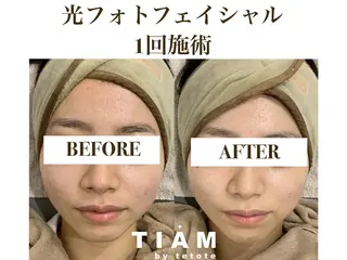 美肌サロンTIAM by tetoteのエステ・リラクイメージ