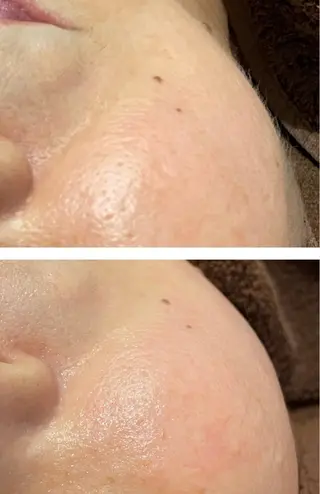 肌質改善◇結果重視 美麗-MIREI-のマツエク・マツパデザイン