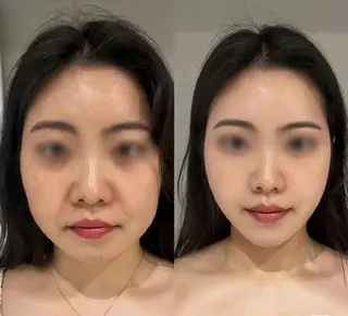 aliaハイフ&水光ジェットサロン所属・aliaハーブ水光店 エステティシャン募集のエステ・リラクイメージ