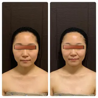 あるる所属・韓国式小顔矯正 担当ゆいのエステ・リラクイメージ