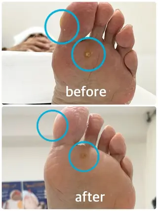 足・爪トラブル専門店　foot grace所属・加藤 望のネイルデザイン