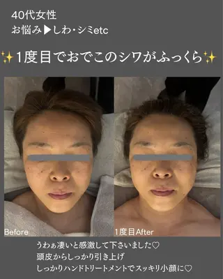 BLOSSOM 菊地のエステ・リラクイメージ