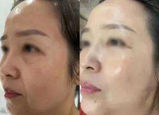 マツエク・マツパ aliaハイフ&水光ジェットサロン所属・aliaハーブ水光店 エステティシャン募集のエステ・リラクイメージ