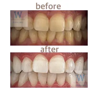 ホワイトニング ショップ本八幡店のエステ・リラクイメージ