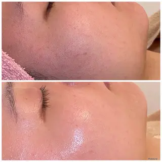 3glitter 肌質改善＆痩身のエステ・リラクイメージ