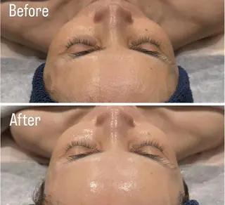 アンド ミルルのエステ・リラクイメージ