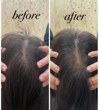 ate'所属・個室ドライヘッドスパ 🍃moriのエステ・リラクイメージ