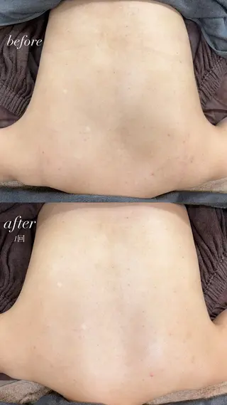 foi🌿 Samiraのエステ・リラクイメージ