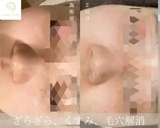 Grandir所属・ハーブピーリング専門 グランディール　武内のエステ・リラクイメージ