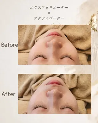 シェービングサロン アンダブル/鴨井のエステ・リラクイメージ