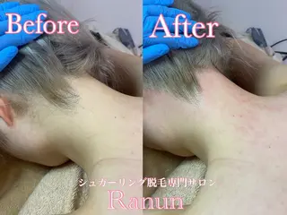 マツエク・マツパ シュガーリング脱毛 専門店Ranunのエステ・リラクイメージ