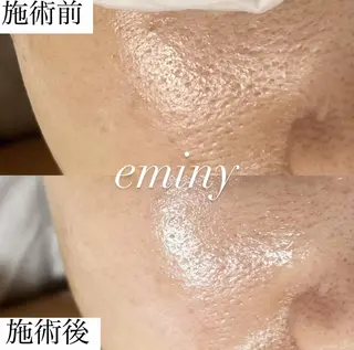 EMINY （エステティシャン）のエステ・リラクイメージ