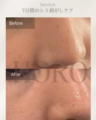 毛穴が見えなくなるサロン  Horo所属・岡 えり子のエステ・リラクイメージ
