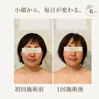 小顔サロンラヴィ　　船橋馬込沢店所属・小顔サロンラヴィ 船橋のエステ・リラクイメージ