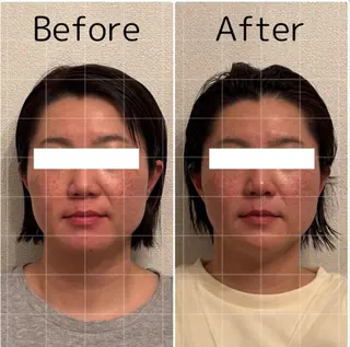 Lily luce 美骨小顔矯正のその他イメージ