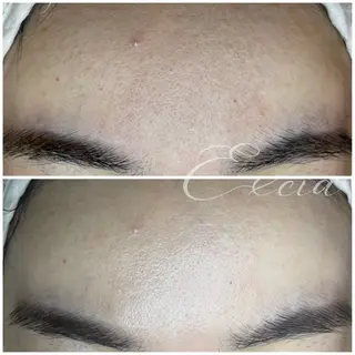 EXCIA所属・EXCIA （エクシア）のエステ・リラクイメージ