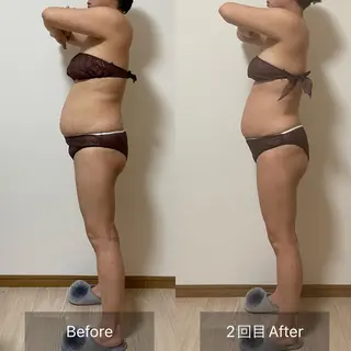 未病ケアサロン EMINY所属・未病ケアサロン EMINY☺︎勝俣のエステ・リラクイメージ