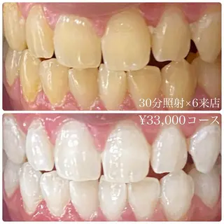 PLATINUM Beauty 横浜店所属・ホワイトニングルーム 横浜店のその他イメージ